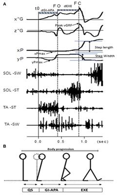 Anticipatory Postural Adjustments During Gait Initiation in Stroke Patients